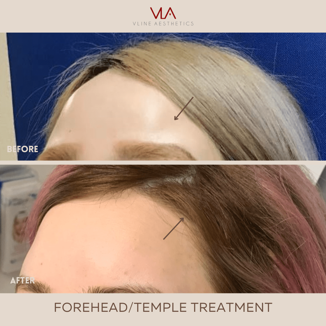 Comfort Blend - Skin Perfect Brothers Powered by VLA