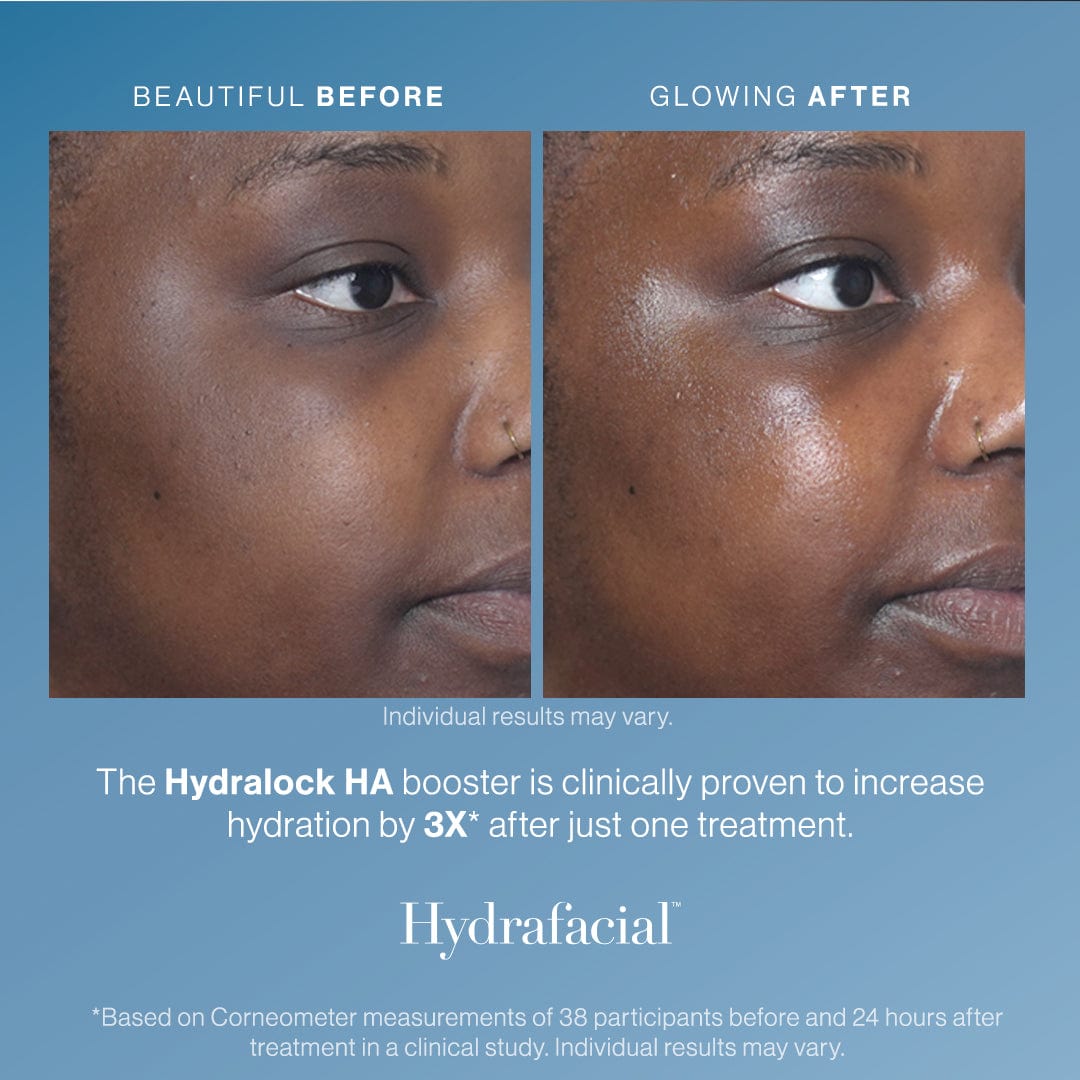 The 3D Trifecta Glow Package