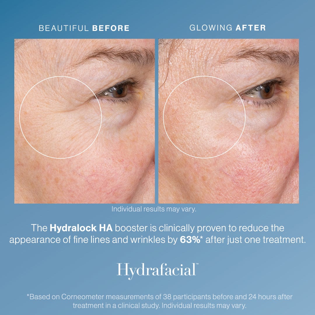 The 3D Trifecta Glow Package