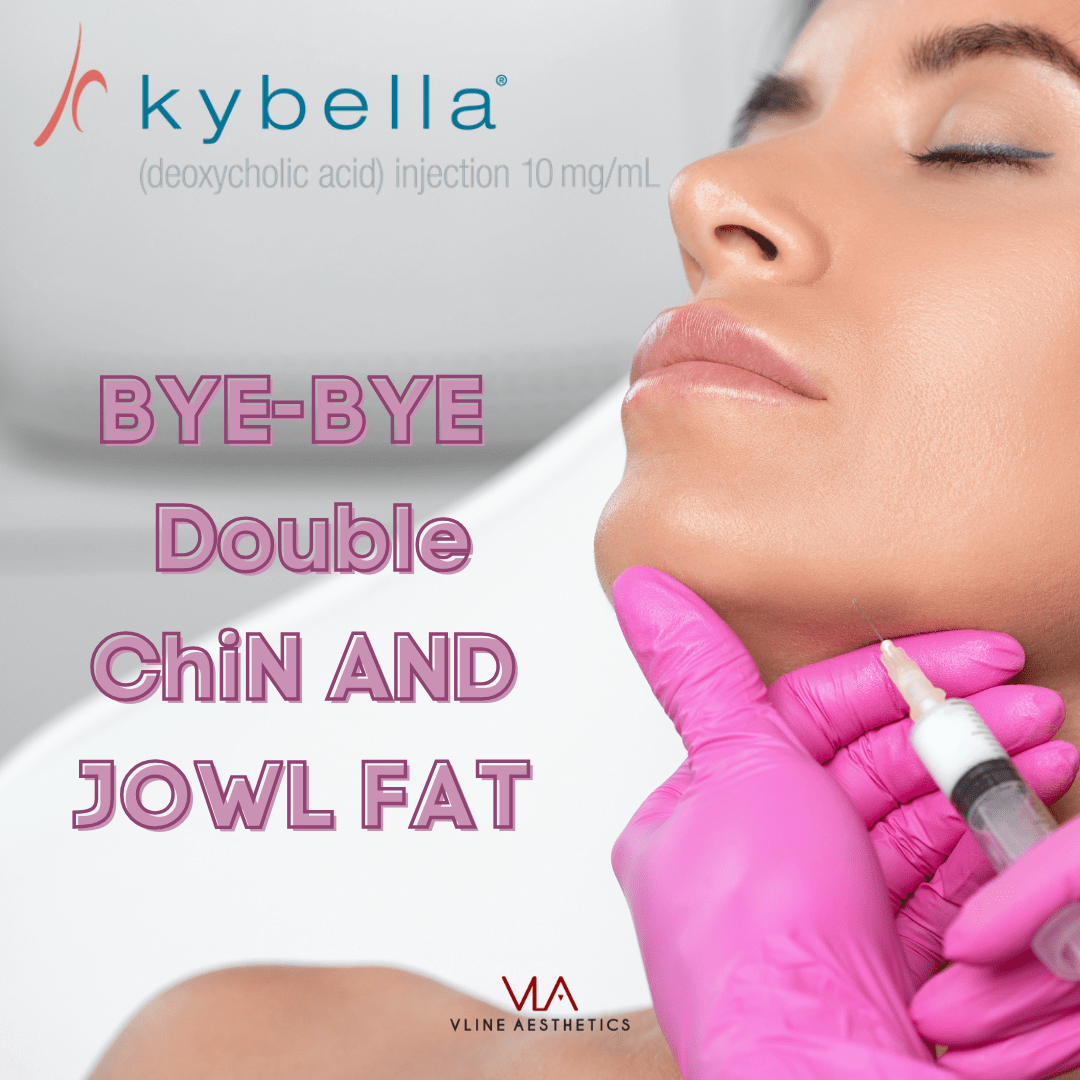 Jowl Fat Removal - Kybella Treatment - Skin Perfect Brothers Powered by VLA