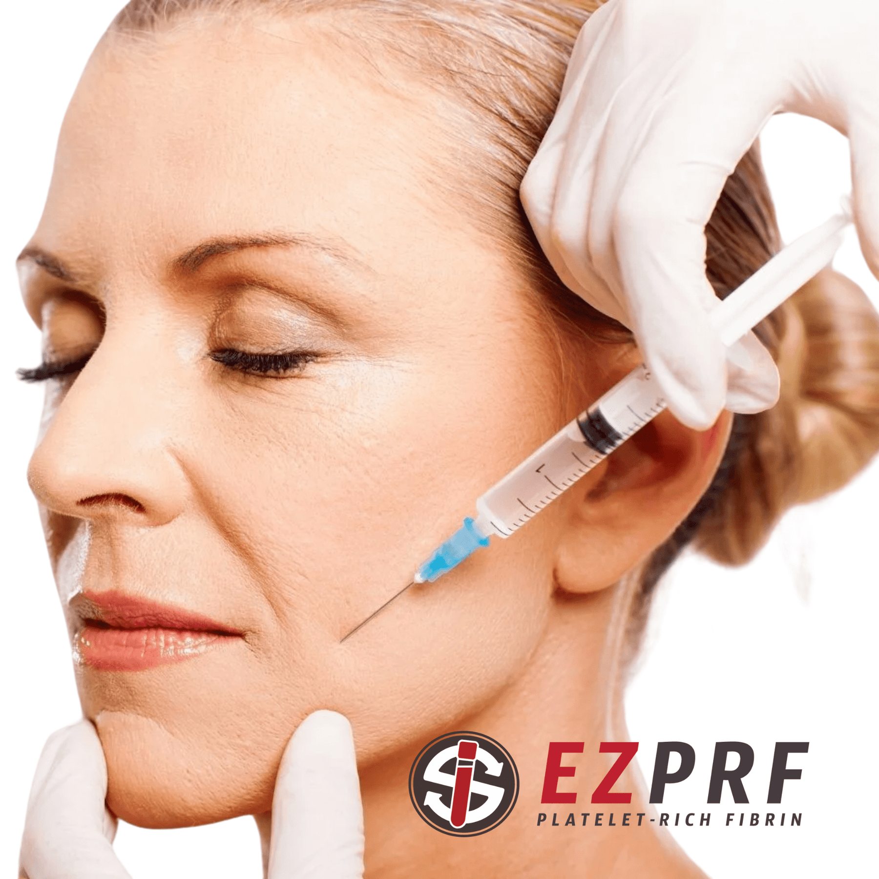 Vampire Eye Treatment - Platelet-Rich Fibrin (PRF) - Skin Perfect Brothers Powered by VLA