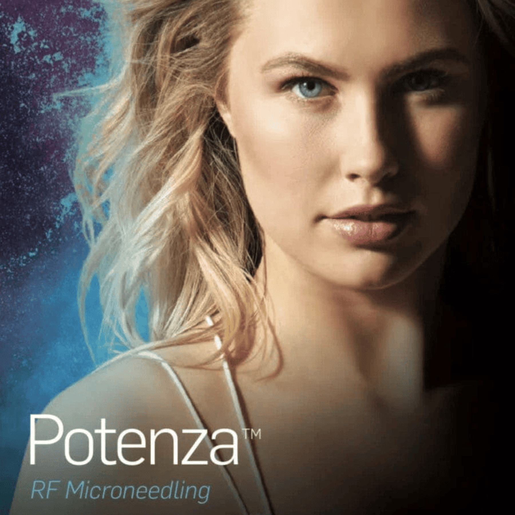 Potenza | RF Microneedling with Exosome - Skin Perfect Brothers Powered by VLA