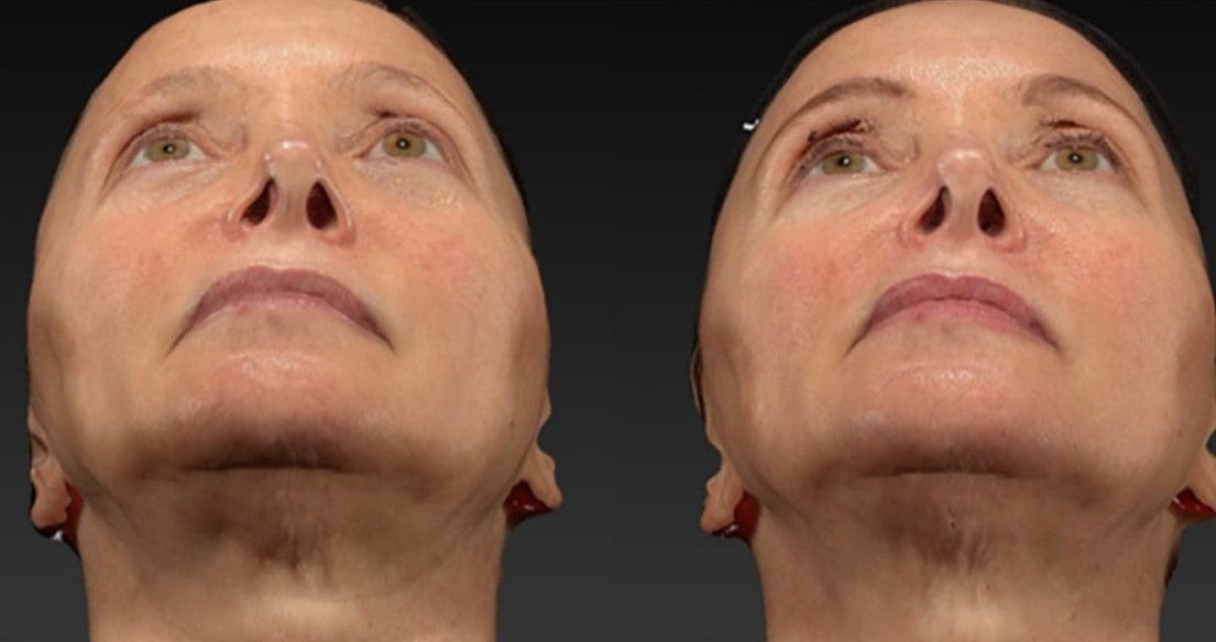 Swan Neck Package - Skin Perfect Brothers Powered by VLA