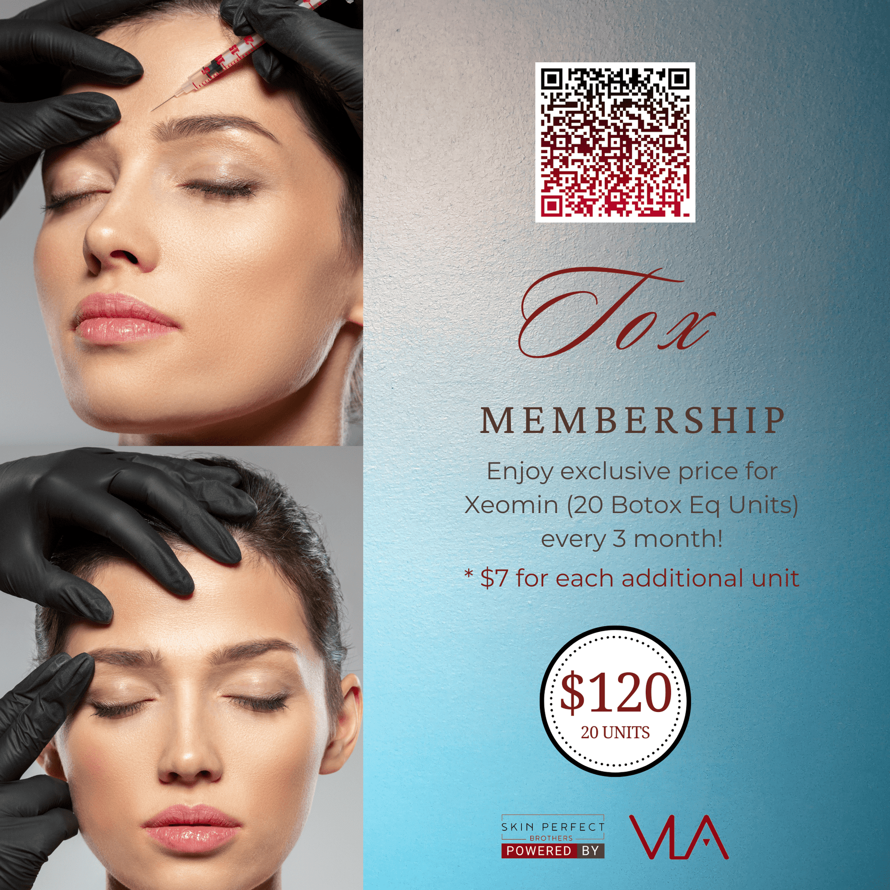 Tox membership (20 units - every 3 month) - Skin Perfect Brothers Powered by VLA