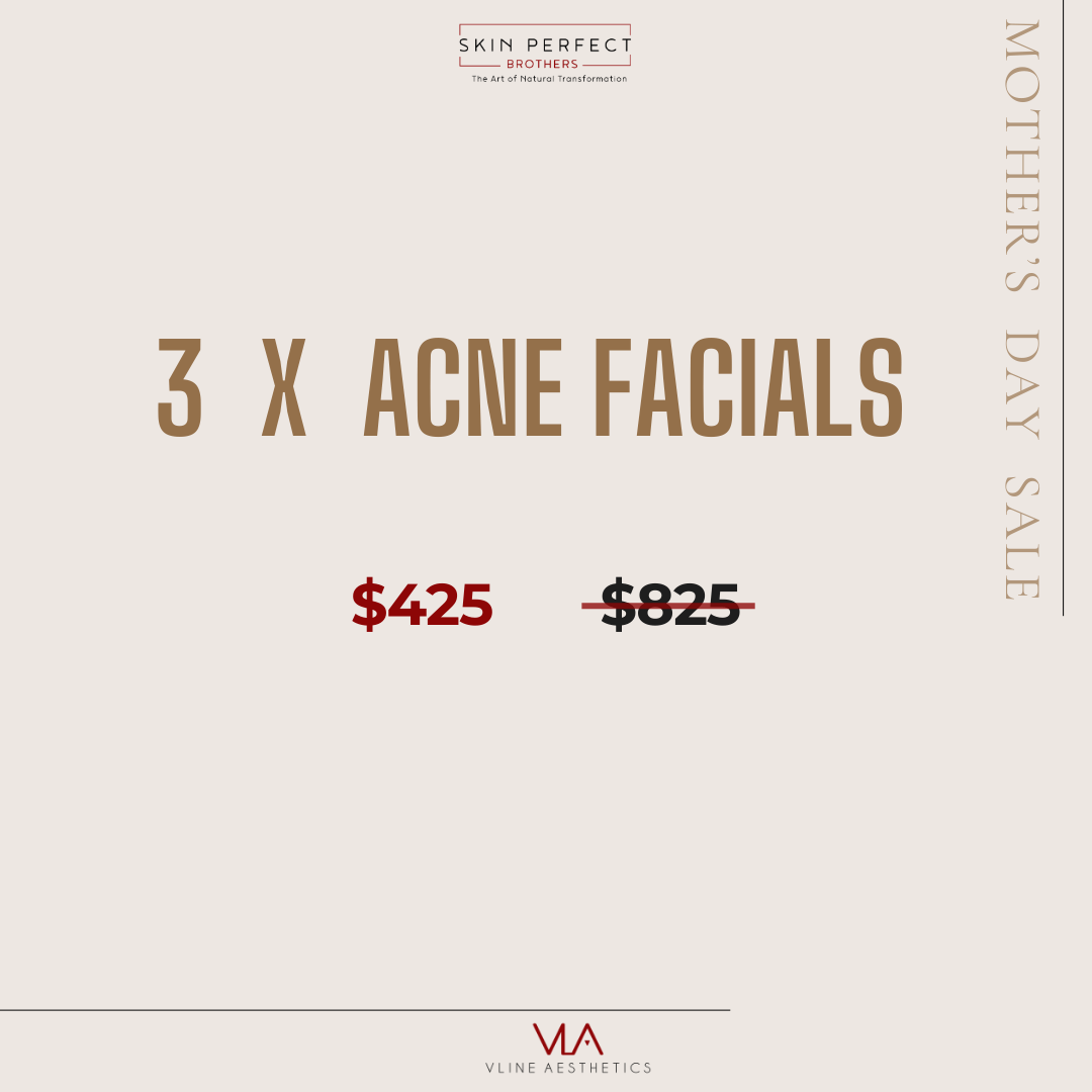 Acne Facial (x3) - Skin Perfect Brothers Powered by VLA