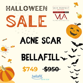 Acne Scars / 1 Bellafill - Skin Perfect Brothers Powered by VLA