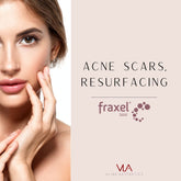 Acne Scars, Resurfacing / Fraxel (x3) - Skin Perfect Brothers Powered by VLA
