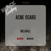 Acne Scars / 1 Bellafill