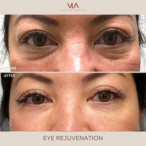 Eye Rejuvenation (Comfort Blend) - Skin Perfect Brothers Powered by VLA