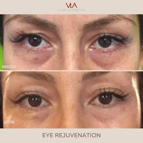 Eye Rejuvenation (Comfort Blend) - Skin Perfect Brothers Powered by VLA