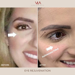 Eye Rejuvenation (Comfort Blend) - Skin Perfect Brothers Powered by VLA