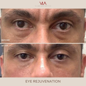 Eye Rejuvenation (Comfort Blend) - Skin Perfect Brothers Powered by VLA