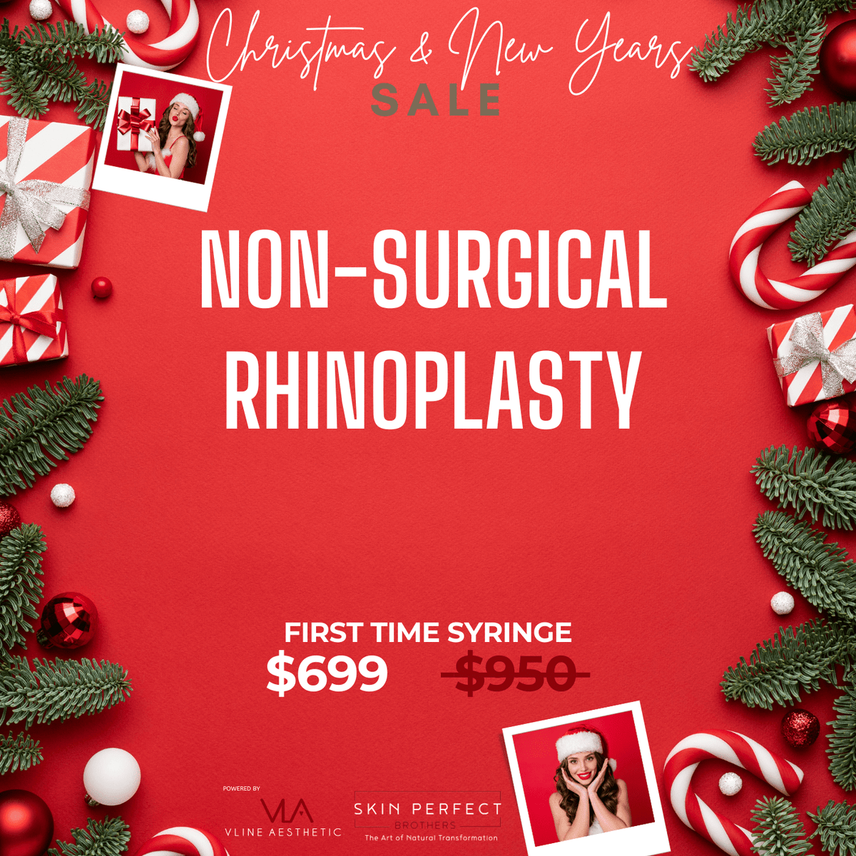 Non-Surgical Rhinoplasty - First syringe