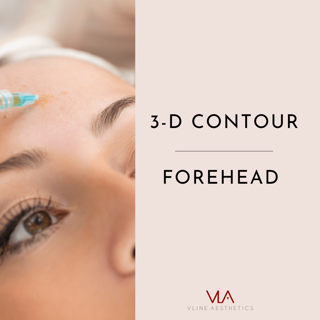 3D Forehead Contour - Skin Perfect Brothers Powered by VLA