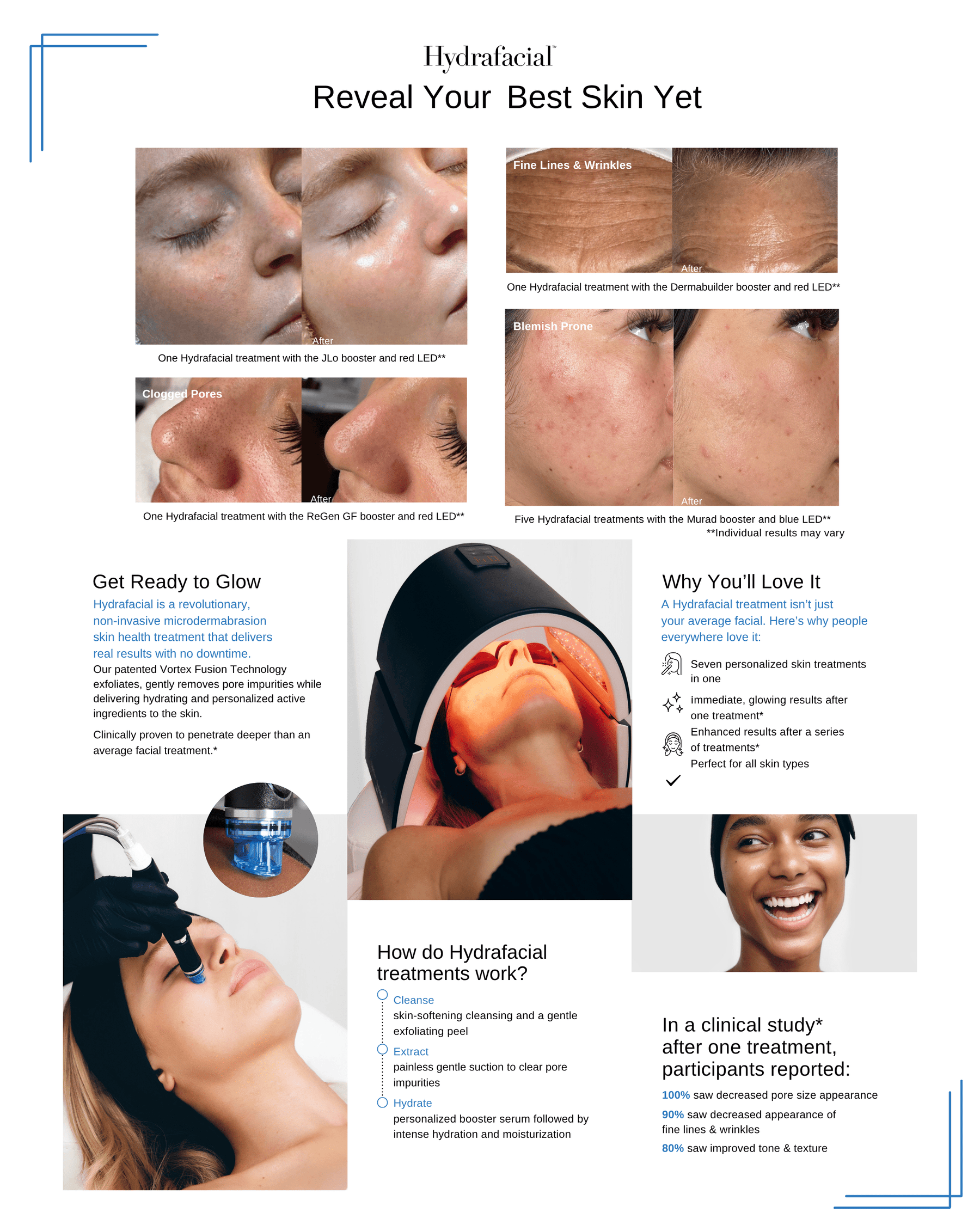 Hydrafacial