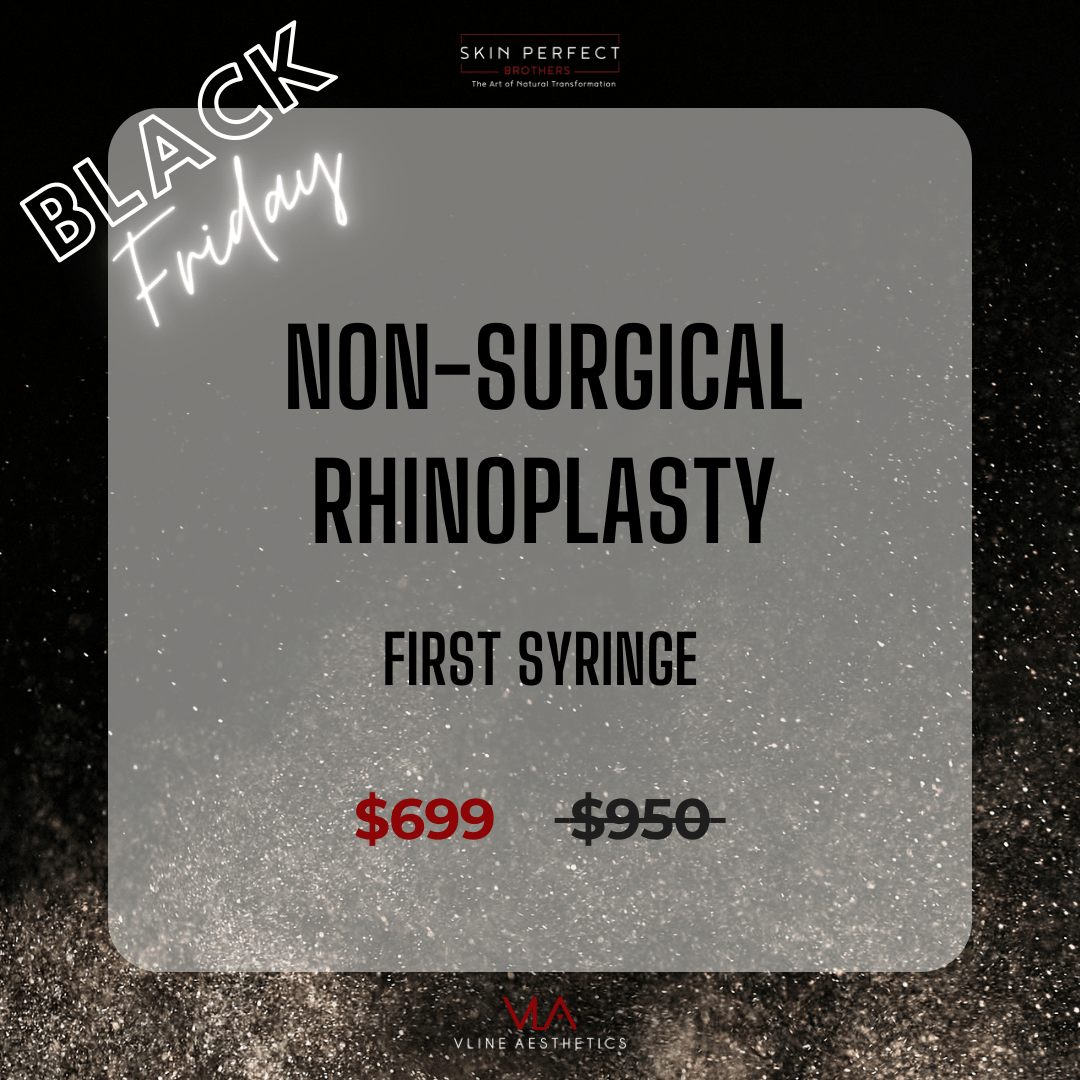 Non-Surgical Rhinoplasty - First syringe