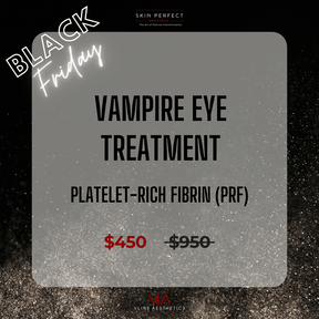 Vampire Eye Treatment - Platelet-Rich Fibrin (PRF)