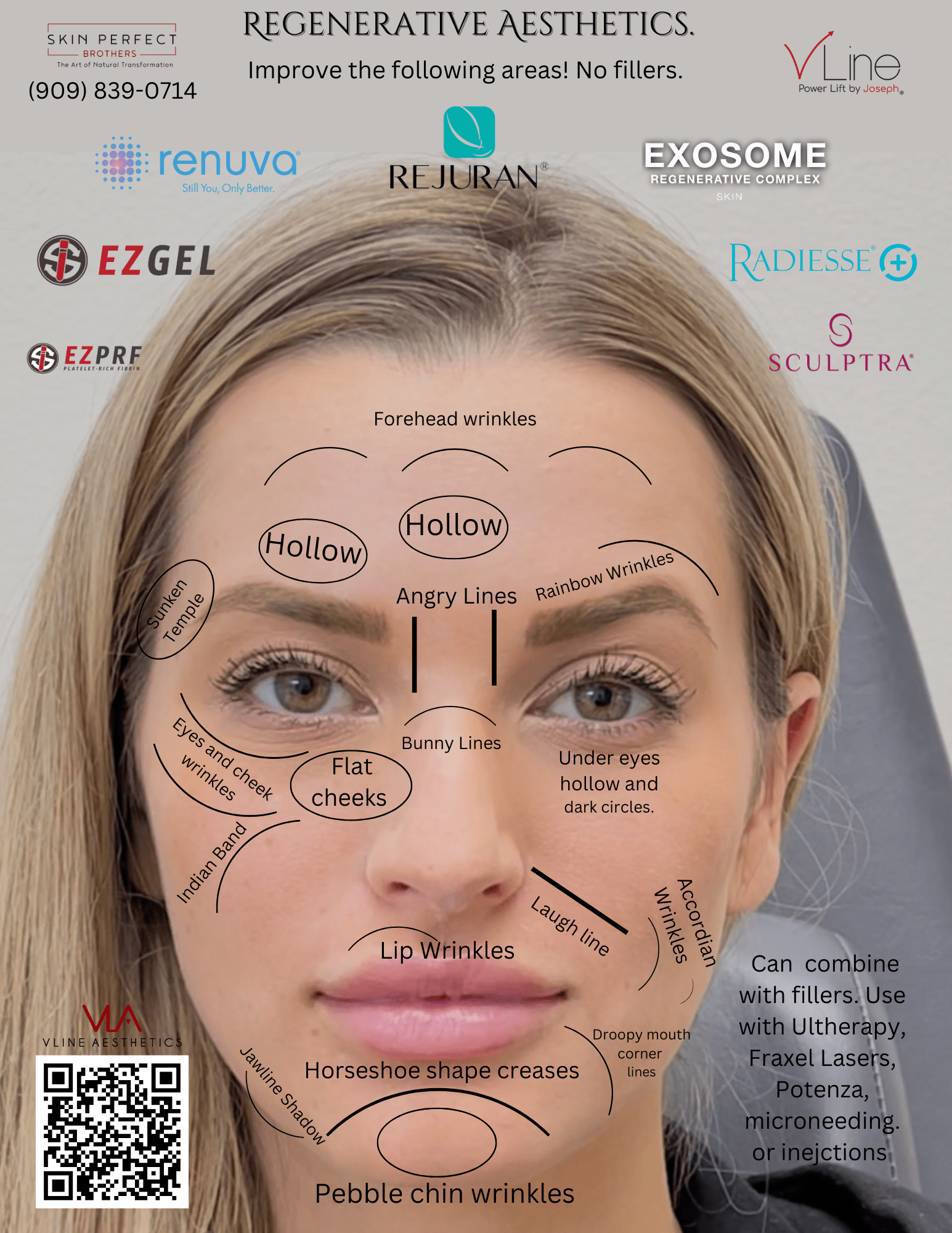 Potenza | RF Microneedling with Exosome