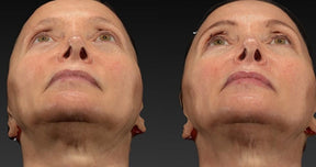 Swan Neck Package - Skin Perfect Brothers Powered by VLA