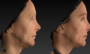 Swan Neck Package - Skin Perfect Brothers Powered by VLA