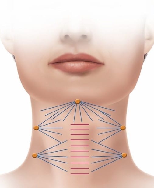 Swan Neck Package - Skin Perfect Brothers Powered by VLA