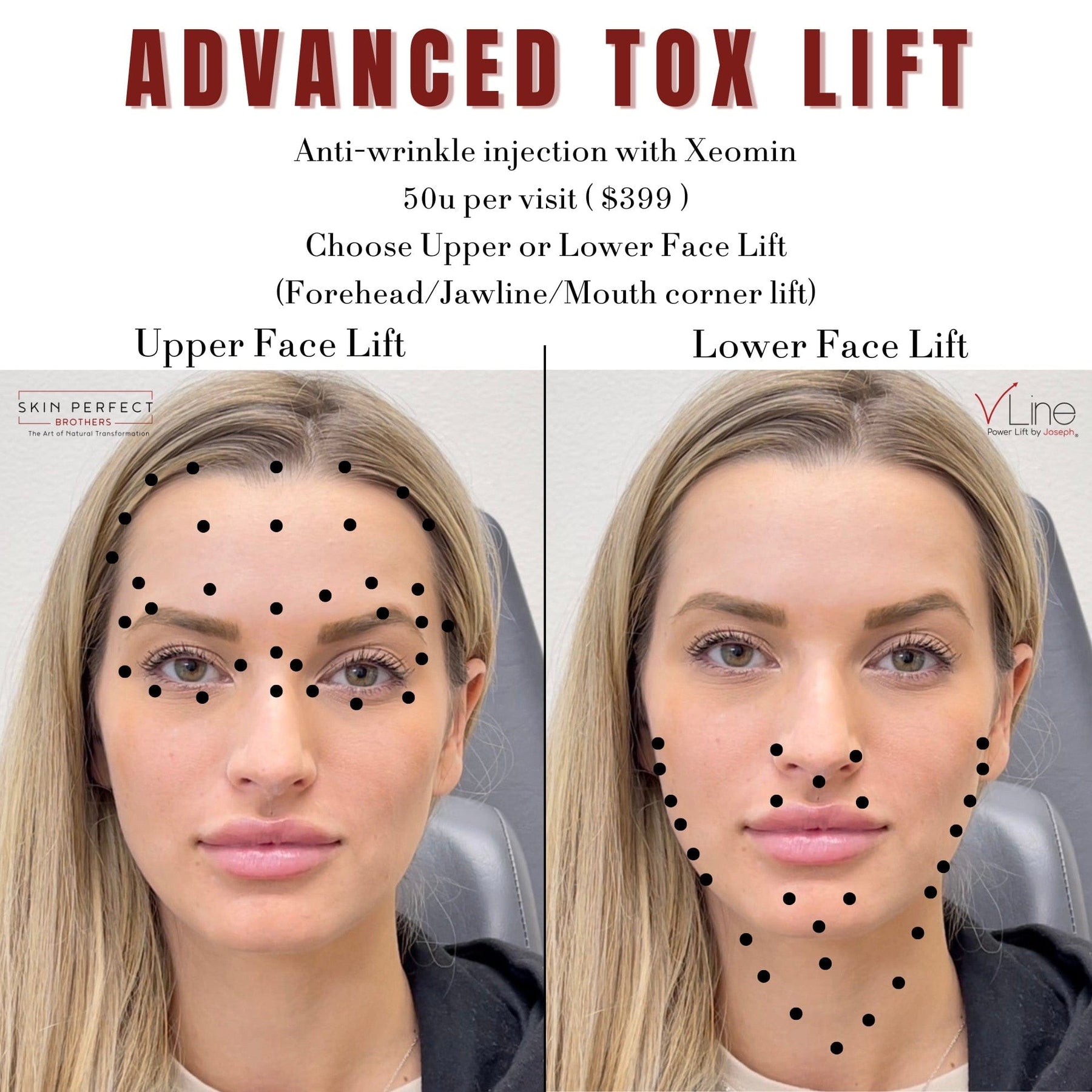 Tox Lift