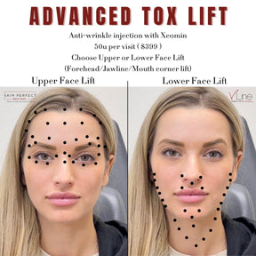 Tox Lift