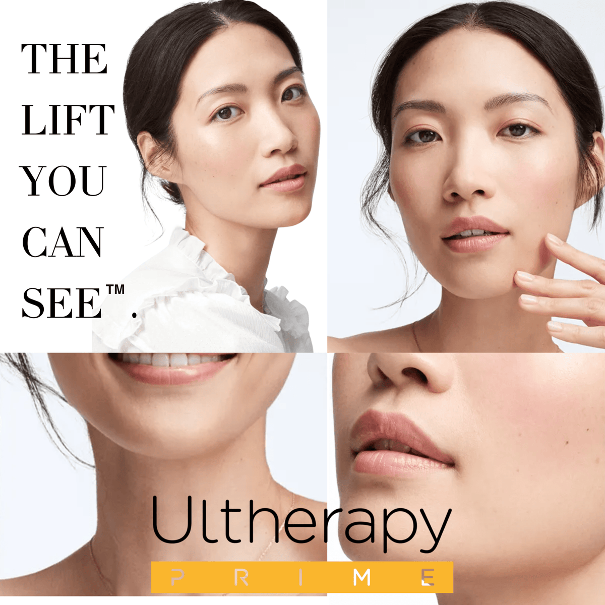 Ultherapy Prime Jawline Lift