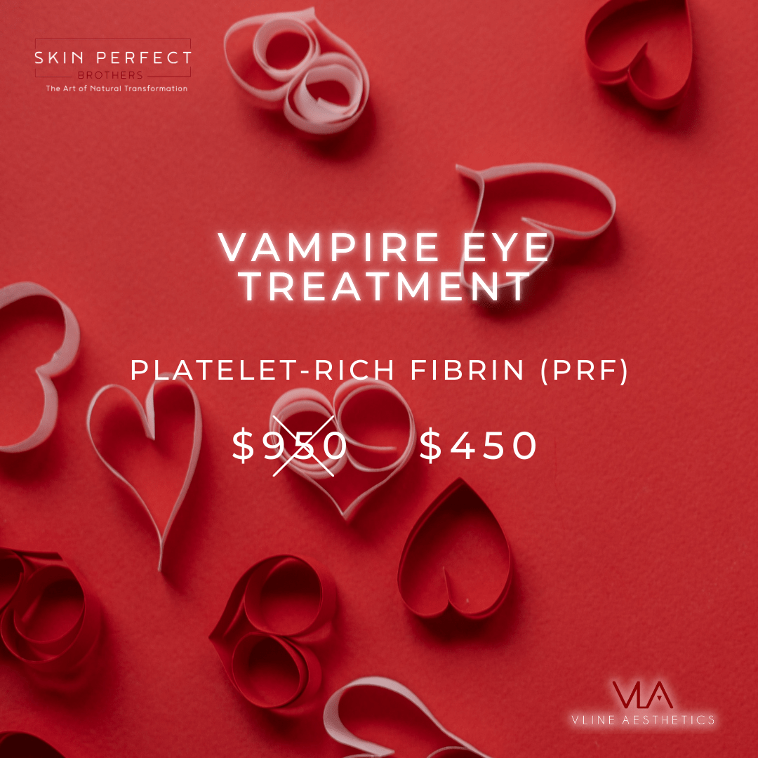 Vampire Eye Treatment - Platelet-Rich Fibrin (PRF) Sale