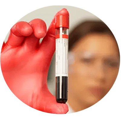 Weight loss drugs can decrease inflammations