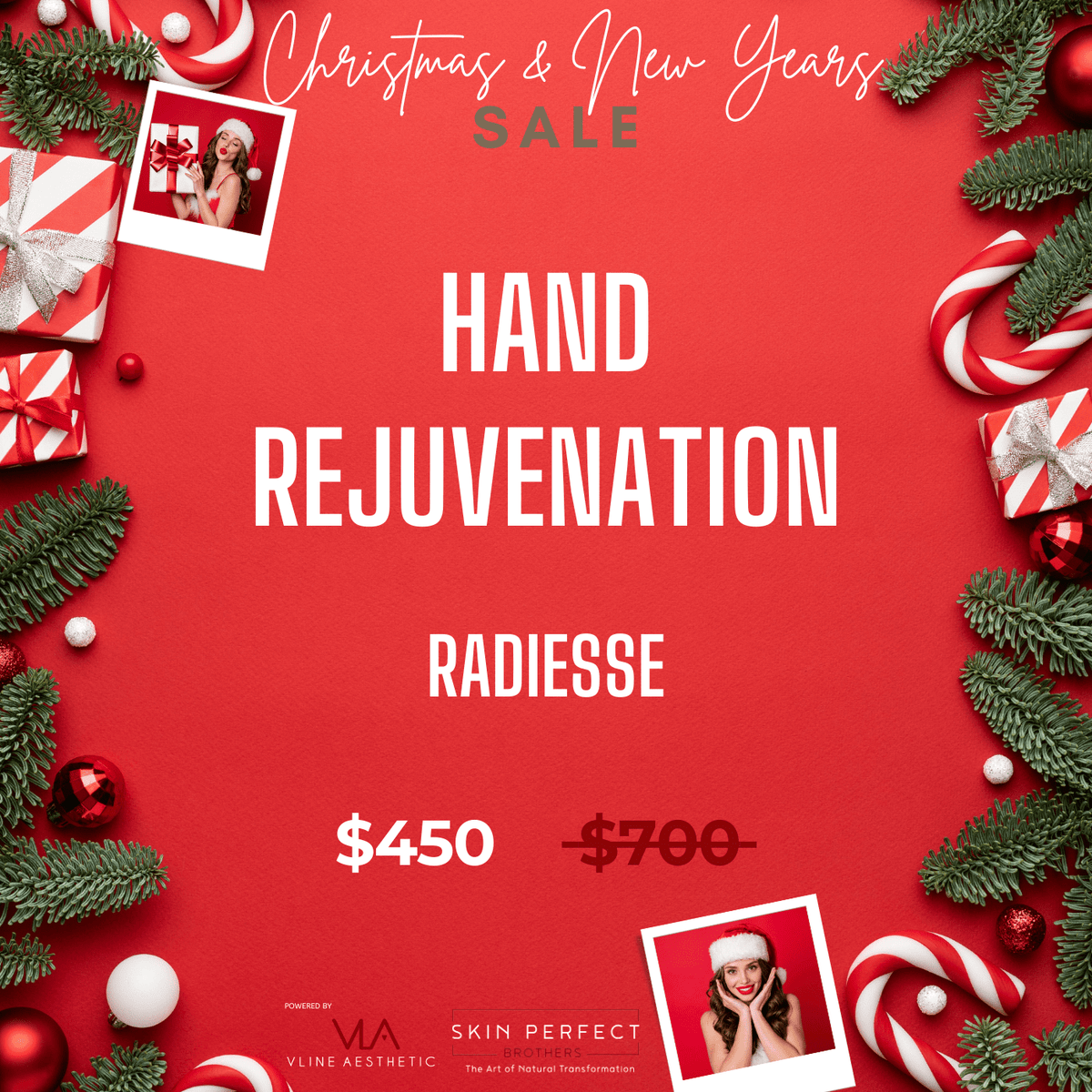 Hand Rejuvenation / 1 Radiesse