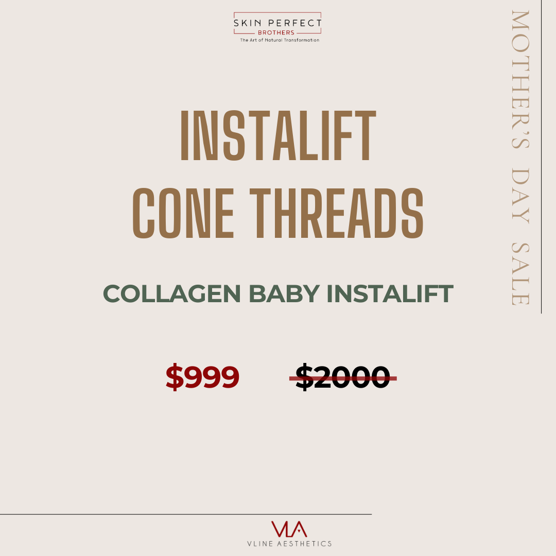 InstaLift Cone Thread / Collagen Baby Instalift - Skin Perfect Brothers Powered by VLA