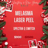 Melasma Laser Peel - Spectra Q Switch