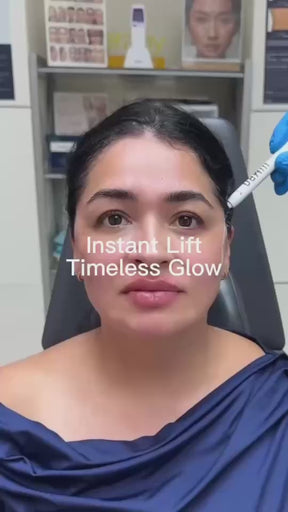 PDO Threads Lower Face (Pick me up)