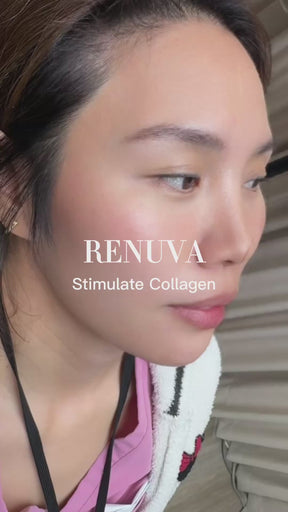 renuva
