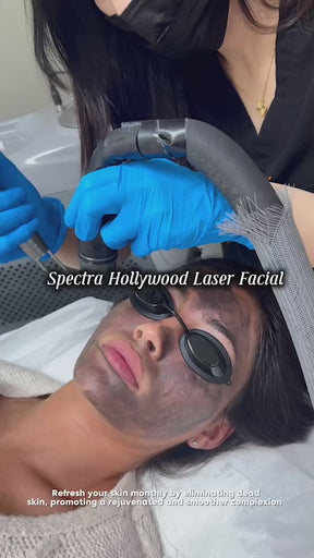 Hollywood Peel Spectra Lasers