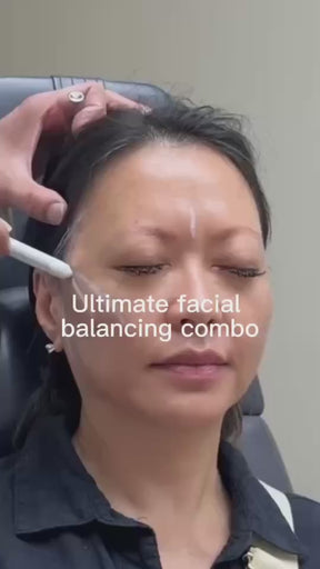 PDO Threads Lower Face (Pick me up)