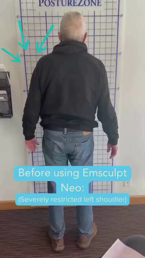 EMSculpt NEO