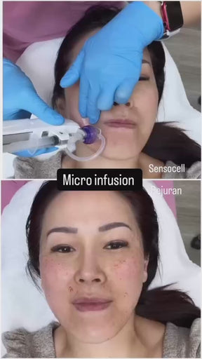 Skin Boosting Infusion
