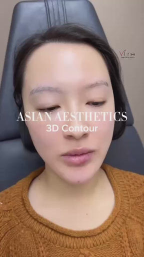 3D Forehead Contour