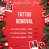 Tattoo Removal