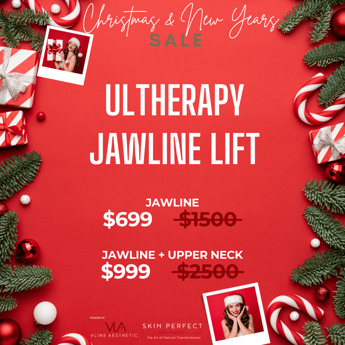 Ultherapy Jawline Lift