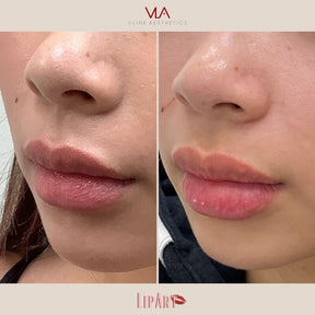 Special | Lip Art - Skin Perfect Brothers Powered by VLA