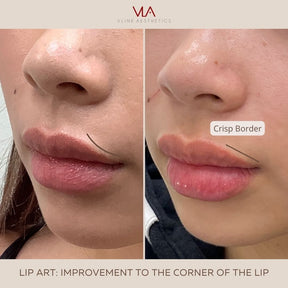 Special | Lip Art - Skin Perfect Brothers Powered by VLA