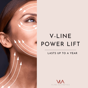V-Line Power Lift | Lasts Up to a Year - Skin Perfect Brothers Powered by VLA